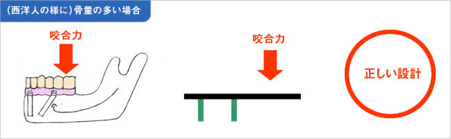 西洋人のように骨量が多い場合の図