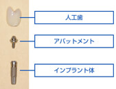 インプラント二次手術（アバットメントの取り付け）の画像