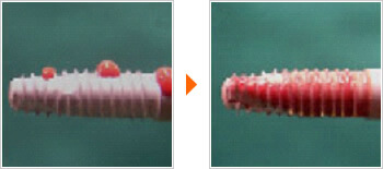 光機能化インプラントの画像