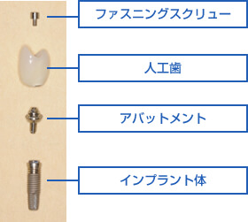 ブローネマルクシステムの3層構造の画像