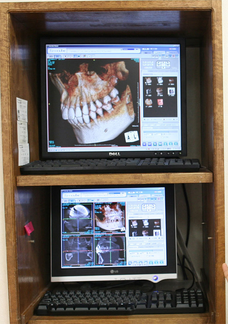 歯科用CT「ファインキューブ」の写真